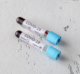 coronavirus-testing-ET8N9RX.jpg